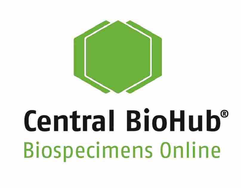 Central BioHub’s Bio samples at the forefront of Cancer Rese