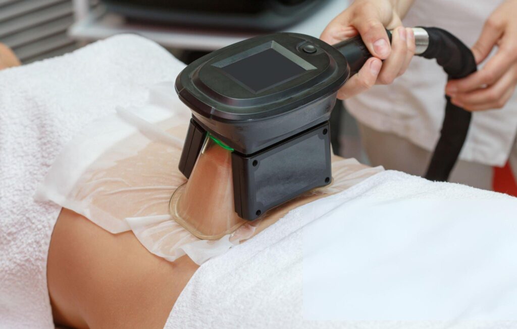 Discover the Benefits of Fat Freezing Bournemouth at Skin Zest