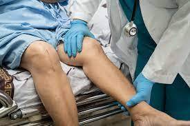 Affordable Hip and Knee Surgery in Karachi: Dr. Shohab’s Consultation Options