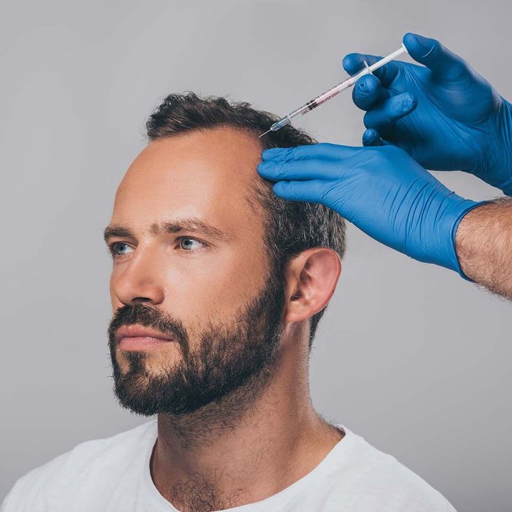 PRP Hair Treatment: Is It the Right Choice for You?