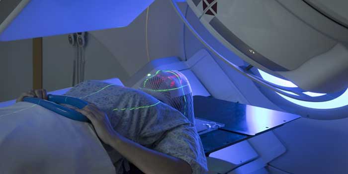 Radiation Therapy for Head and Neck Cancers: What Patients Should Know