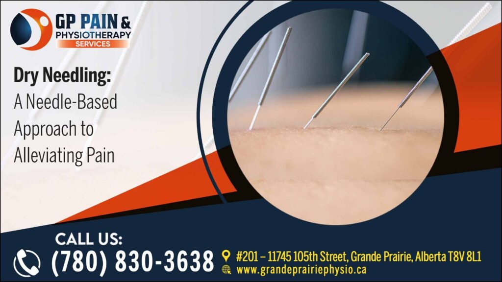 Dry Needling for Swimmers: Improving Flexibility and Power