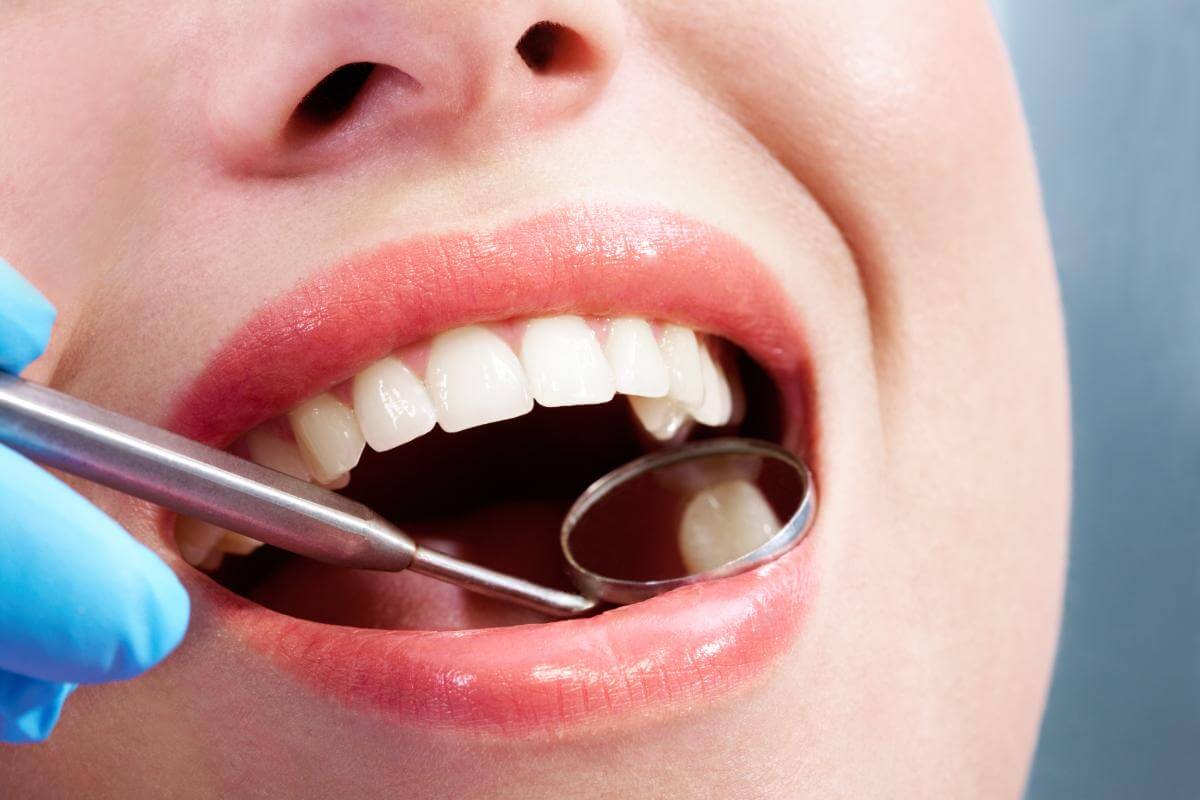 How Much Does a Tooth Filling Cost? A Complete Guide