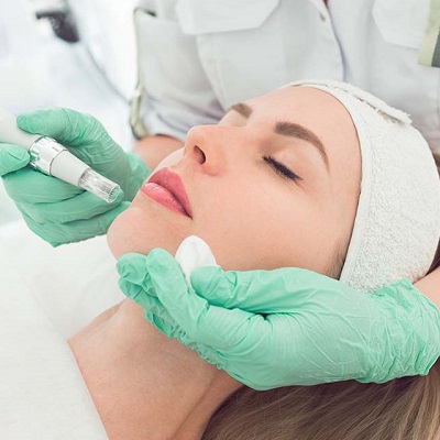 The Truth About Cold Peel and Skin Lightening
