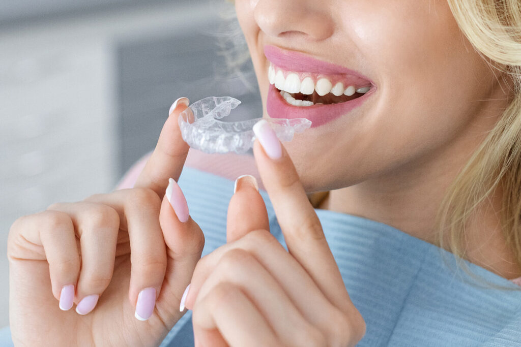 Invisalign Cost Breakdown: How Much Does It Really Cost?