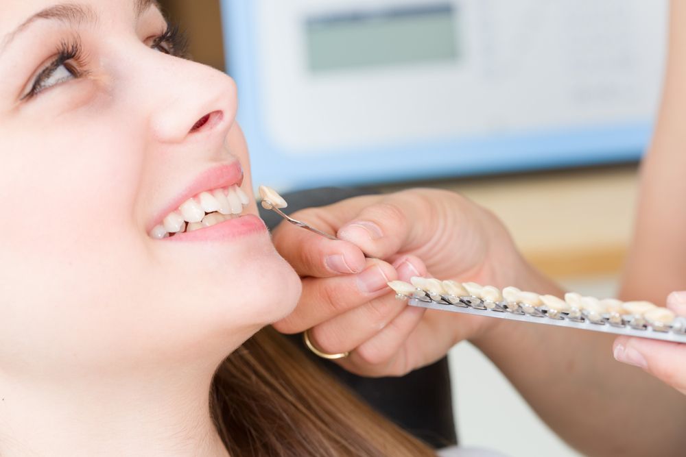 Dental Veneers Explained: Your Path to a Beautiful Smile