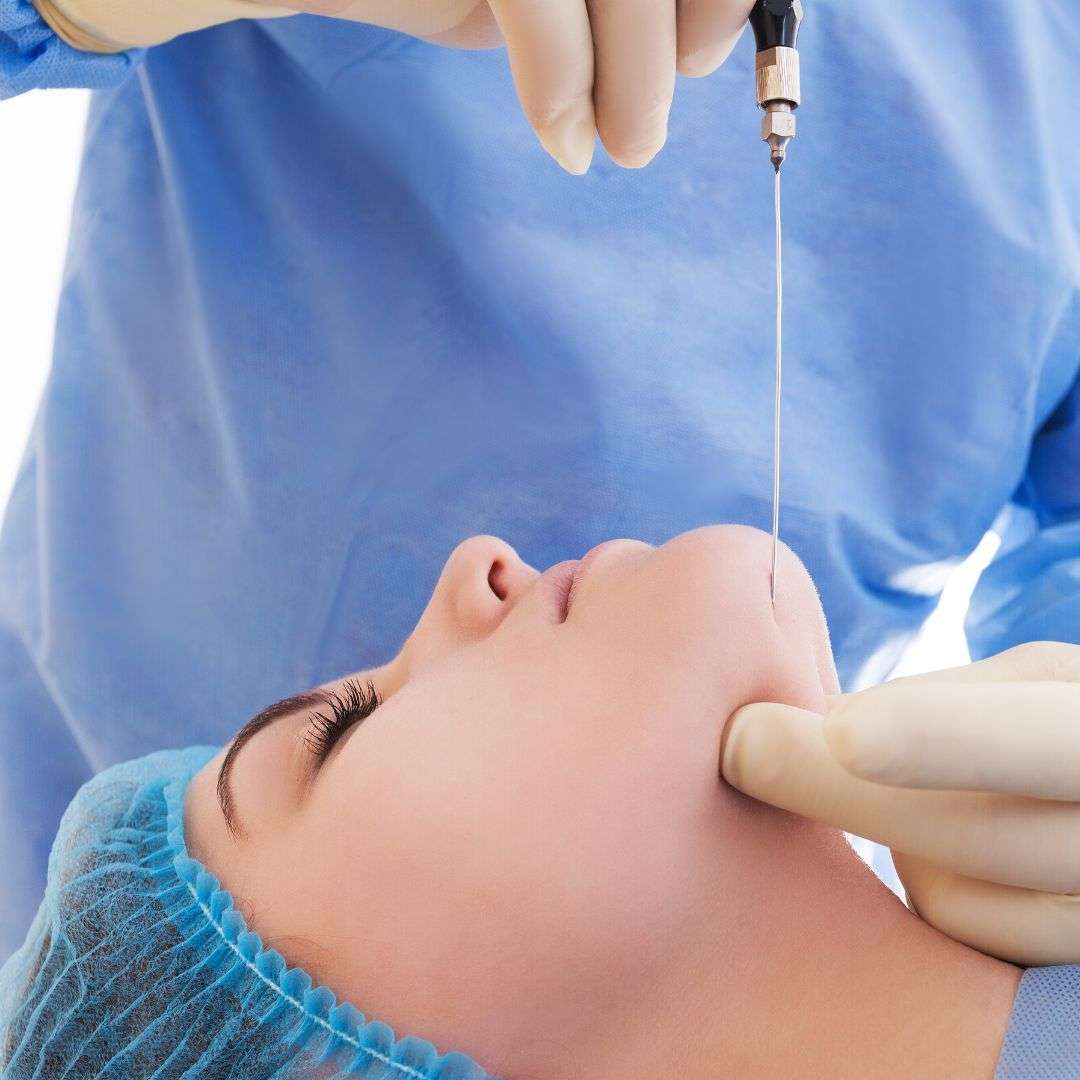 Rejuvenate Your Look with Endolift in Dubai