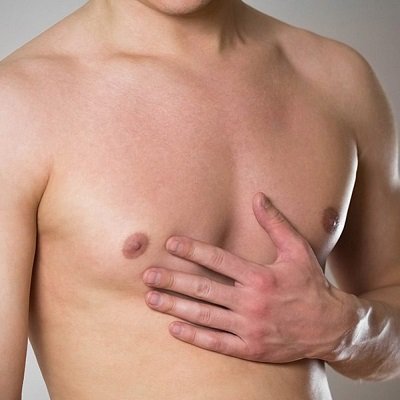 How to Get Rid of Gynecomastia in Dubai
