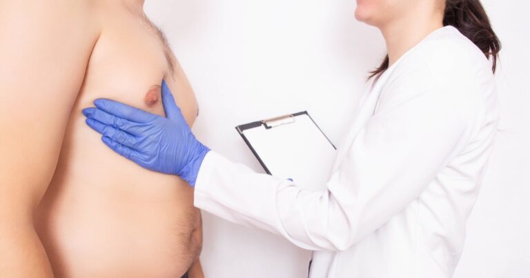 Gynecomastia Surgery: Fast & Lasting Results