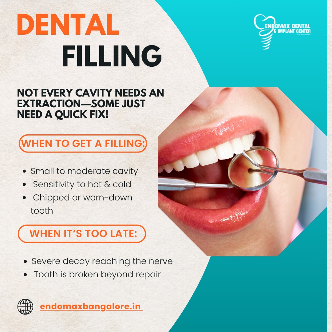 Amazing Dental Implants in Bangalore: Your Path to a Perfect