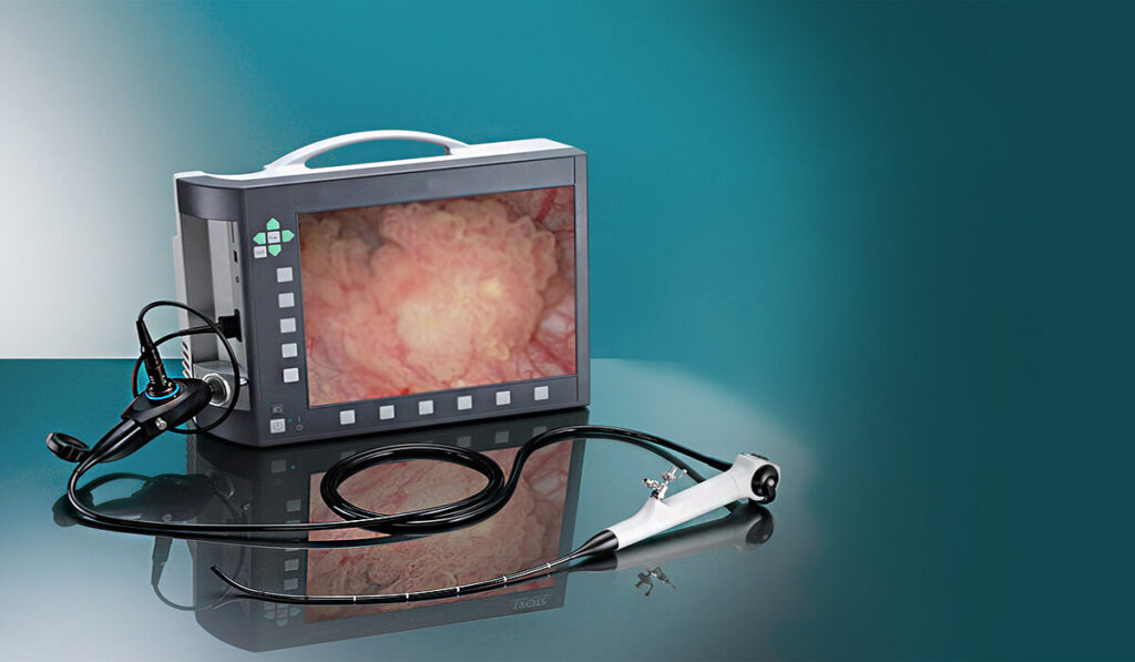Shining a Light on the Cystoscope Market: Trends, Innovations, and Growth