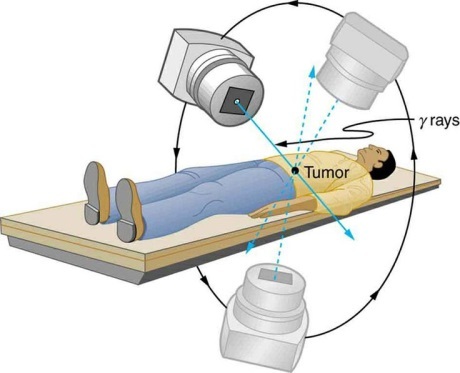 Discover Top Radiation Oncology Treatments in Delhi NCR for Effective Cancer Care