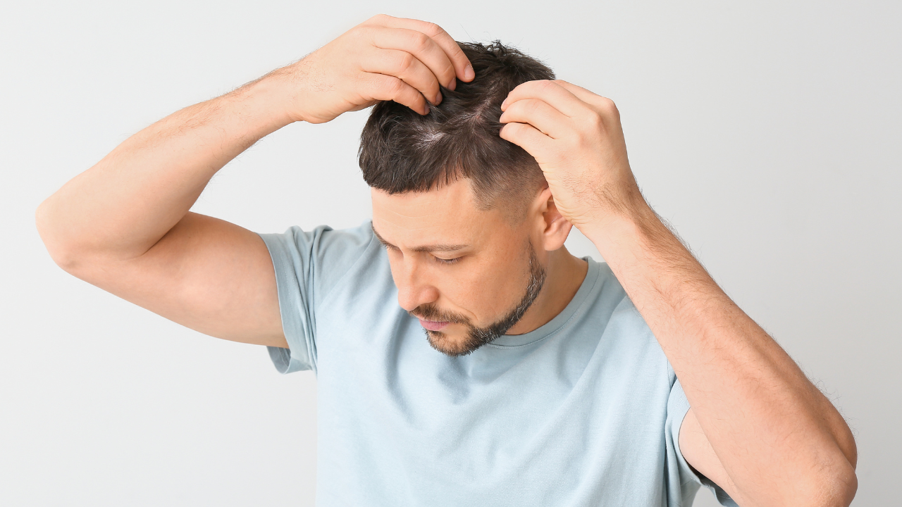 Failed Hair Transplant- Why does it happen and how to fix it?
