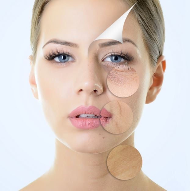 Superficial Chemical Peels: Elevate Your Skincare Routine