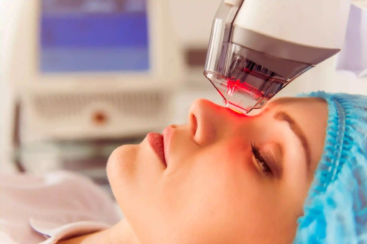 Choose Microneedling to Get a Youthful and Even-Toned Skin