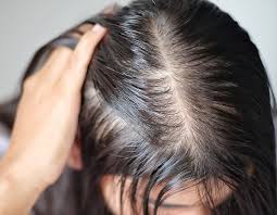 Finasteride: The Breakthrough Solution for Hair Loss