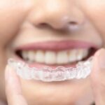 Invisalign: The Discreet Way to Achieve a Beautiful Smile