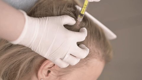 The Natural Way to Fuller Hair: PRP Explained