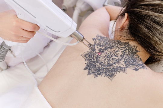 It’s OK to Change Your Mind – We’ll Remove the Ink