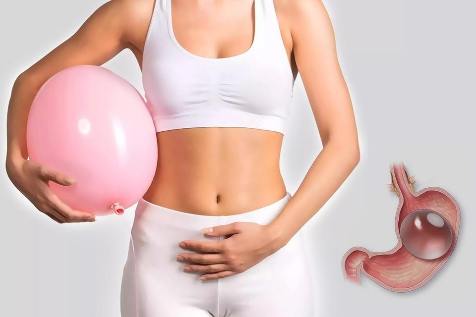 What Is Gastric Balloon Placement?