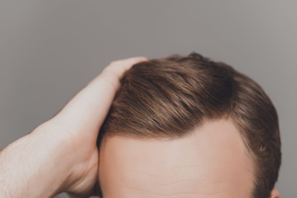 How Does Front Line Hair Fixing Work?