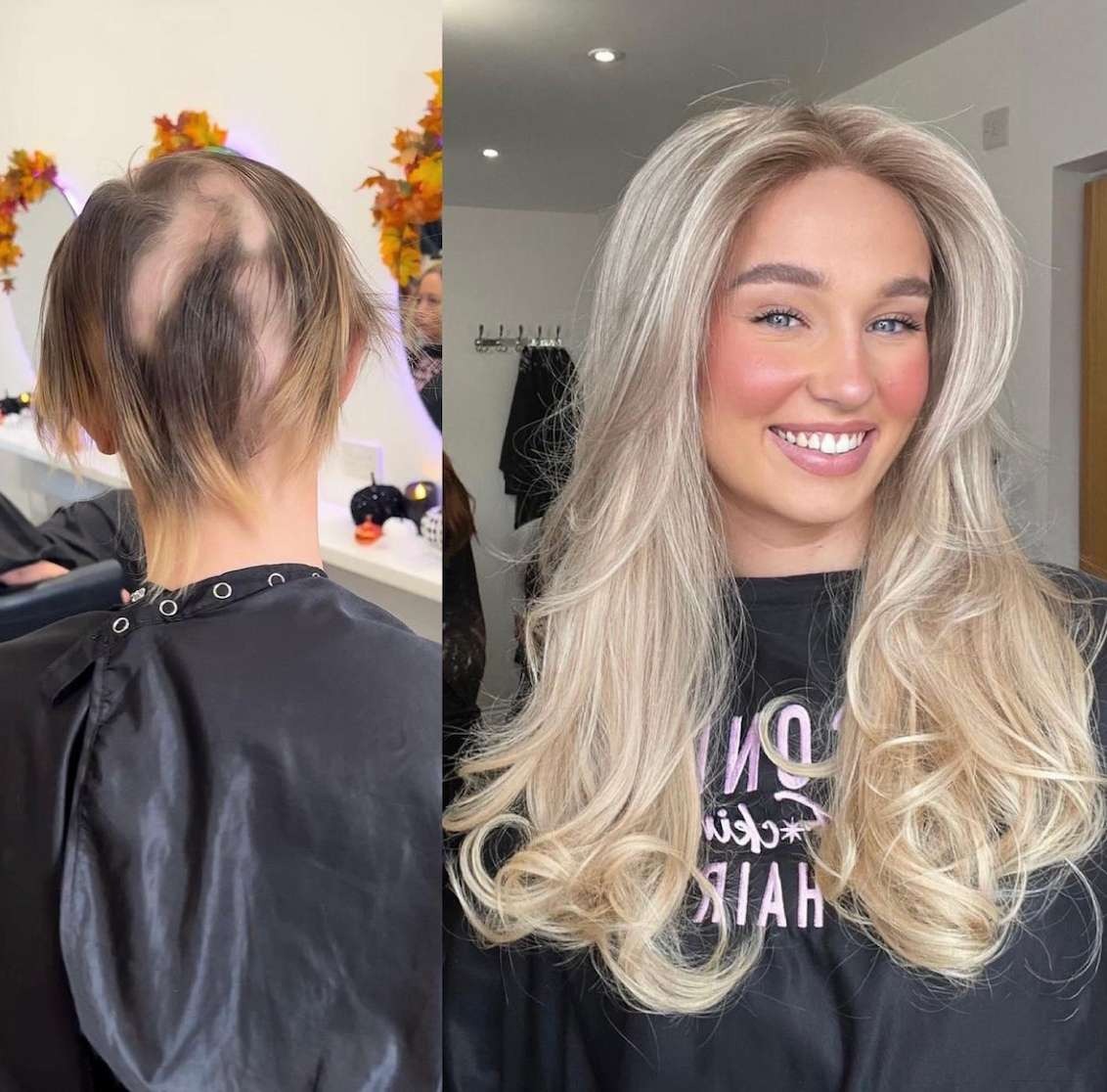 Mesh Integration Systems Vs. Traditional Extensions: What Works Best for Thin Hair?