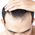 Why Choose Front Line Hair Fixing