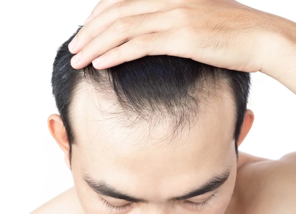Why Choose Front Line Hair Fixing