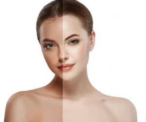 Cold Peel in Dubai