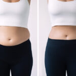 Weight Loss Clinic Near You Today