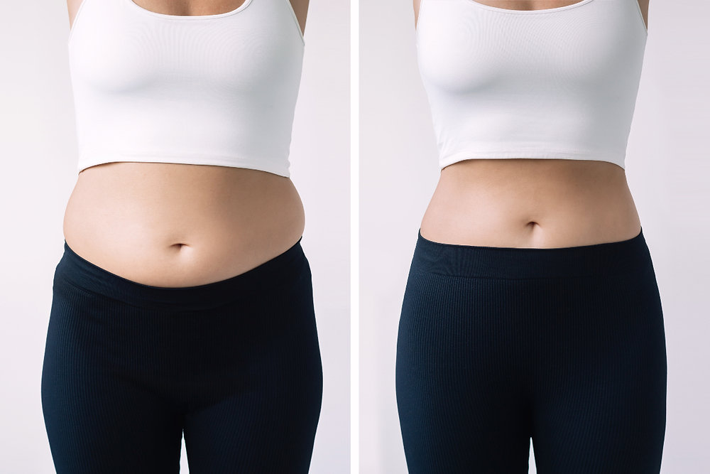 Weight Loss Clinic Near You Today