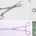 Dental Scissors Explained: Types, Uses & Importance in Modern Dentistry
