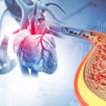 Everything You Need to Know Before Visiting an Angiography Doctor in Jaipur