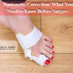 Bunionette Correction: What You Need to Know Before Surgery