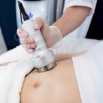 Effective Cellulite Reduction for Athletes