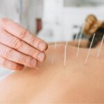 Unlock Pain Relief Techniques with Dry Needling CPD Training