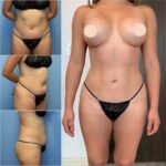 The Best Doctors in Dubai for Body Contouring: Get Results That Enhance Your Confidence