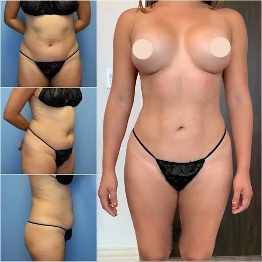 The Best Doctors in Dubai for Body Contouring: Get Results That Enhance Your Confidence