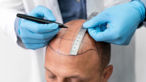 Front Line Hair Fixing in Dubai