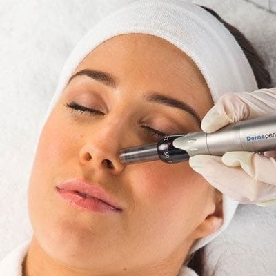Plasma Pen Treatment Cost: What You Need to Know Before Book