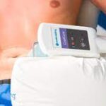 CoolSculpting for Men: Trim and Defined