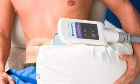 CoolSculpting for Men: Trim and Defined