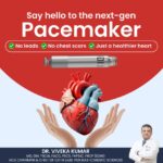 Top 10 Pacemaker Doctors in Delhi – Expert Cardiologists You Can Trust