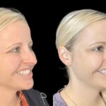 Exploring the Skill of the Best Plastic Surgeon in Dubai for Botox Procedures