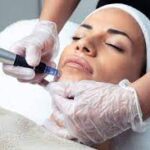 How Mesotherapy Can Transform Your Skin’s Hydration Levels