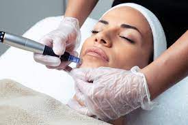 How Mesotherapy Can Transform Your Skin’s Hydration Levels