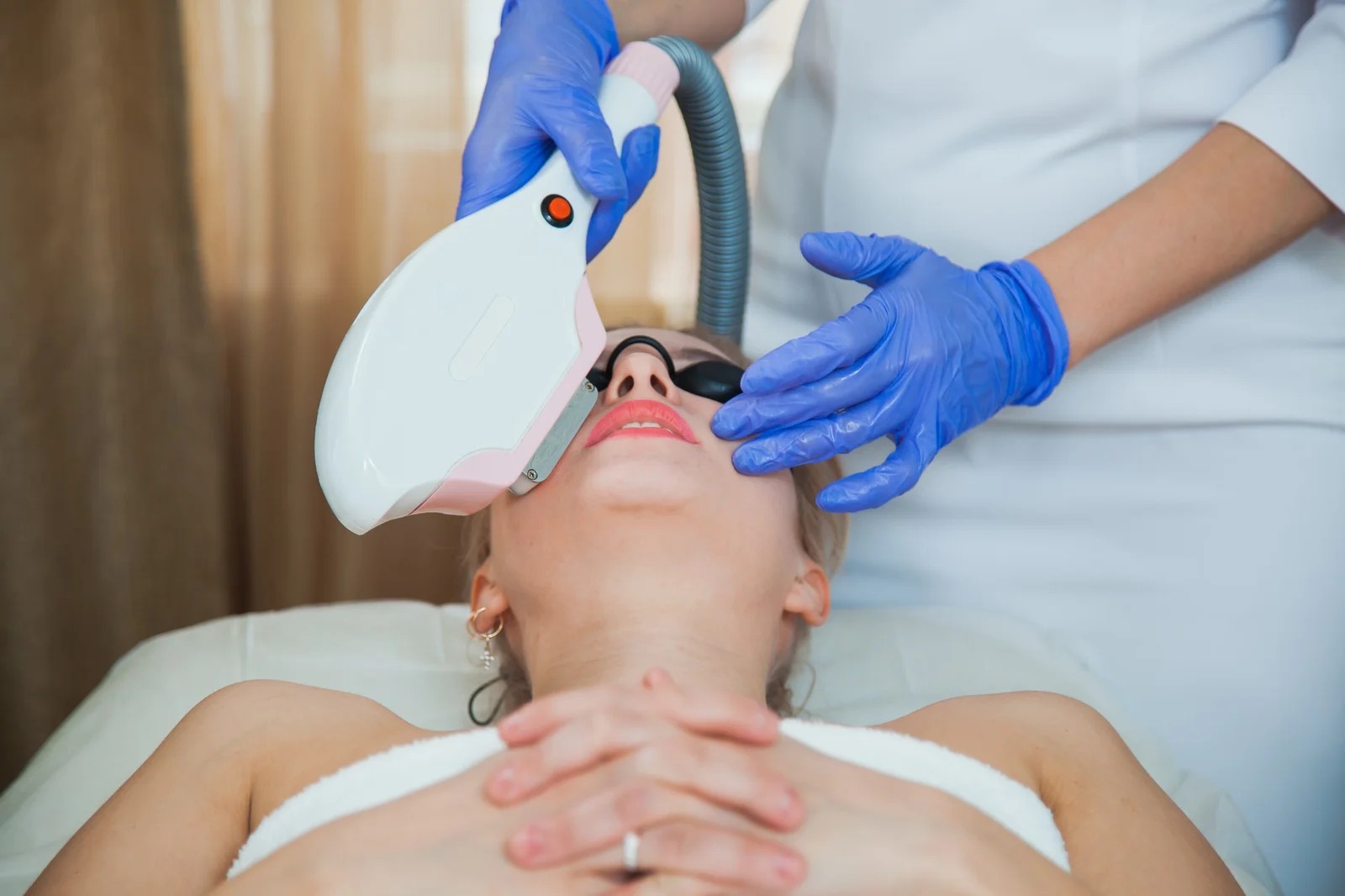 Are laser treatments effective for acne scars?