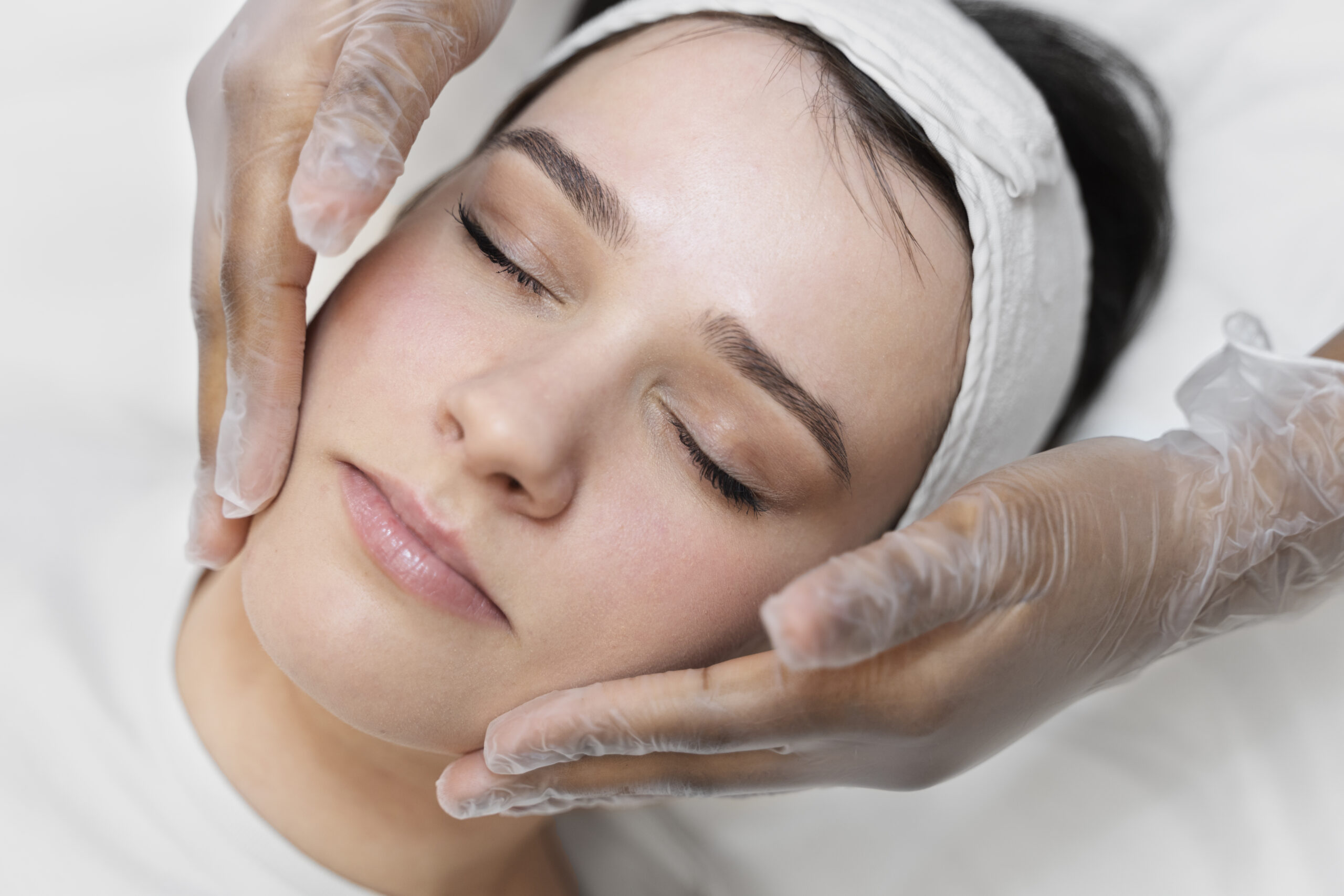 Melasma Treatment Near Me – Right Solution for Clearer Skin