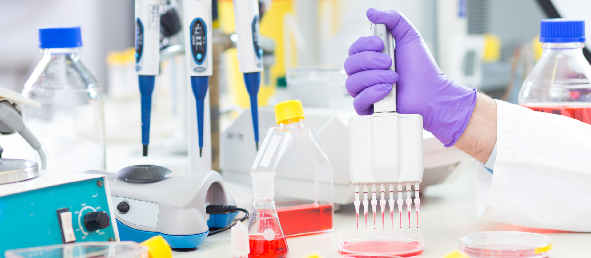 Top 5 Reasons of Using Plasticware in the Lab