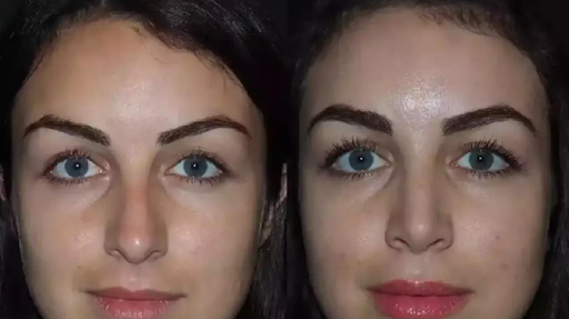 Best Septoplasty Surgeon in Dubai for Breathing Problems